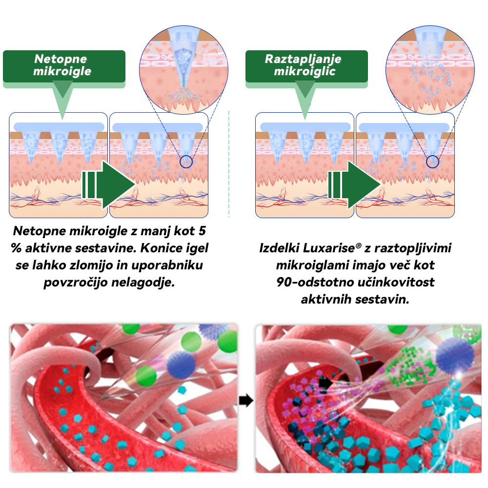 𝑼𝒓𝒂𝒅𝒏𝒂 𝒕𝒓𝒈𝒐𝒗𝒊𝒏𝒂  | 𝑴𝒐𝒓𝒊𝒏𝒈𝒂 𝑿 𝑩𝒆𝒓𝒃𝒆𝒓𝒊𝒏 10-𝑰𝒏-1 𝑵𝒂𝒑𝒓𝒆𝒅𝒆𝒏 𝑵𝒂𝒏𝒐 𝑴𝒊𝒌𝒓𝒐𝒊𝒈𝒍𝒂𝒏𝒋𝒆 𝑵𝒂𝒍𝒆𝒑𝒌𝒂