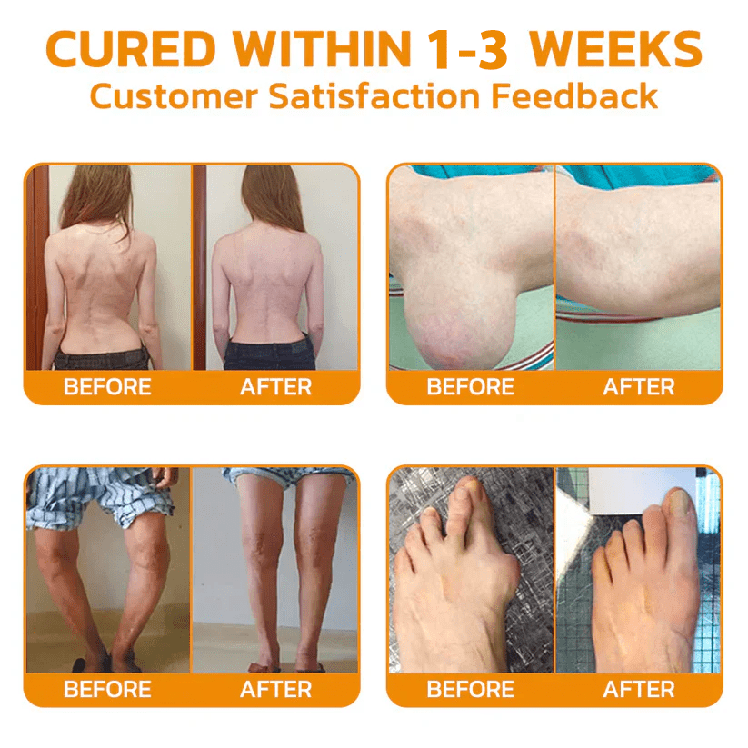 Lidocaine Scar-Free Pain Relief Healing Liquid