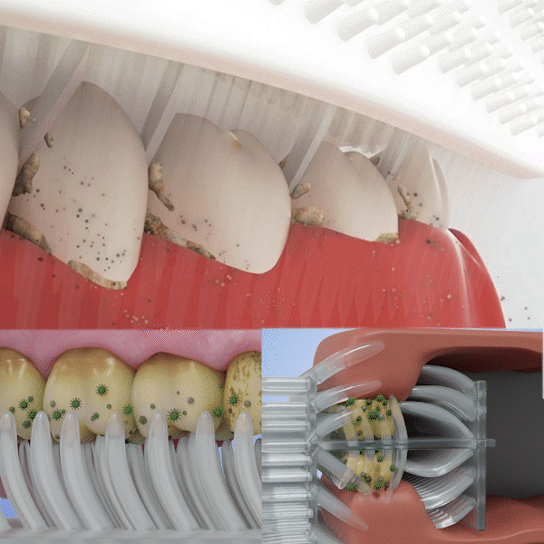 SpeedySmile EZBrush 360 U-Shape Toothbrush