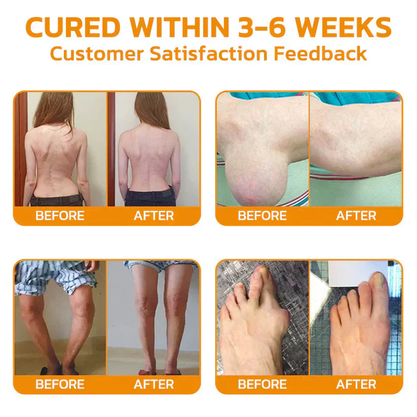 🐝Bee Venom Joint & Bone Recovery Cream