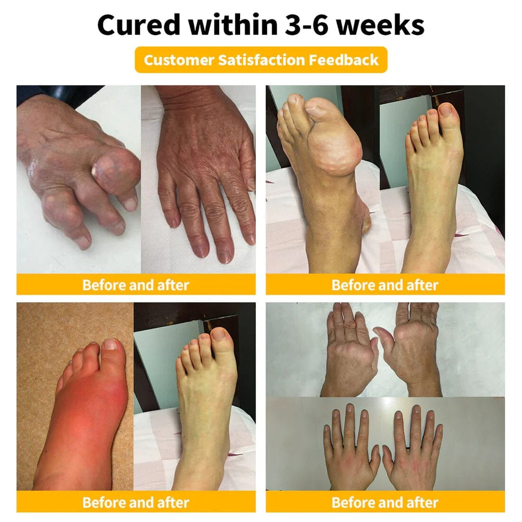 Flysmus™☀️Bee Venom Pain-Relief Bone Healing Cream(Specially for older adults & AOA recommends)