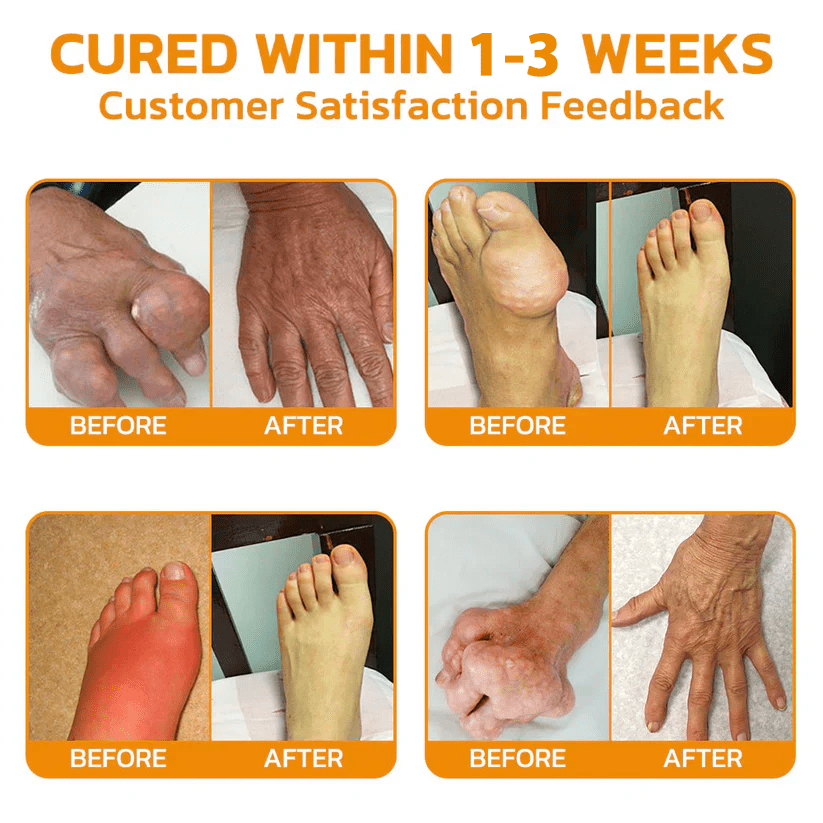 Lidocaine Scar-Free Pain Relief Healing Liquid