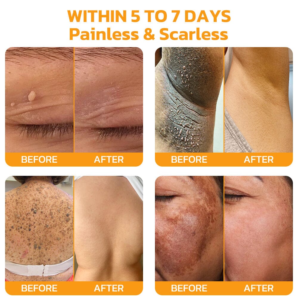 Bee Venom Skincare Treatment Pads