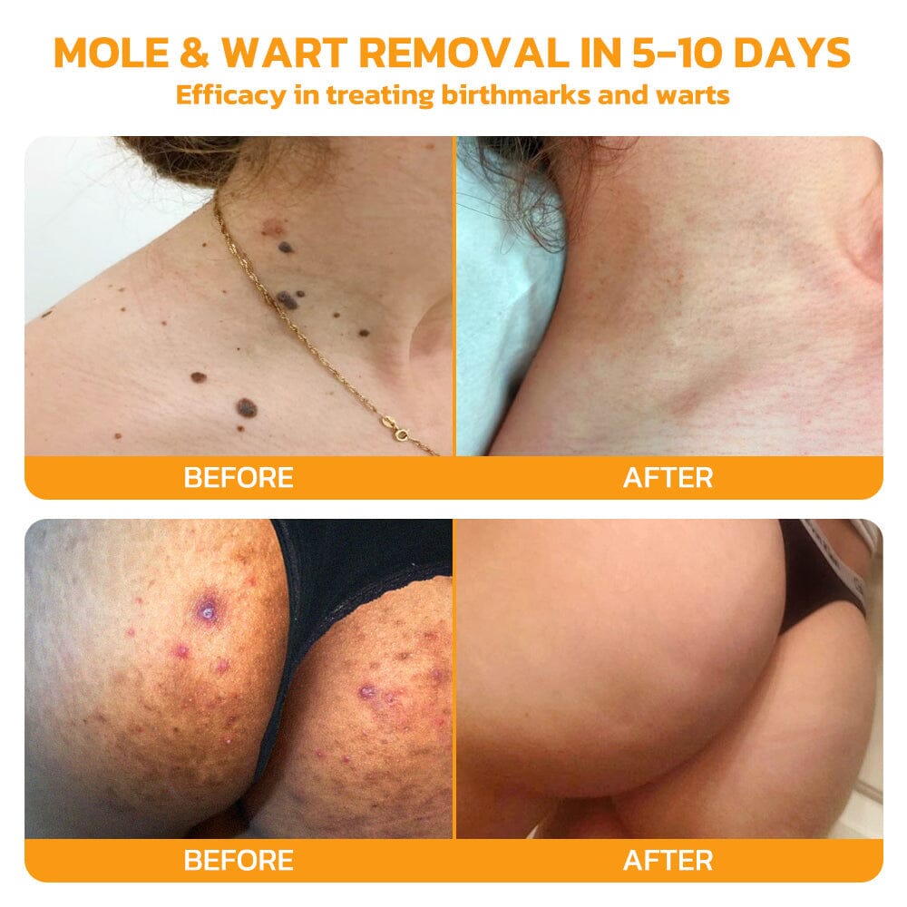 Bee Venom Skincare Treatment Pads